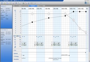 trium_ctg_online_v2_partogram